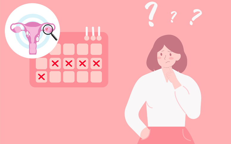 Periods/Menstrual Cycle and PCOS: What Is Affected?